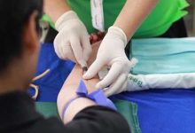 中西医结合治疗肺结核疗效研究-学术期刊期刊服务
